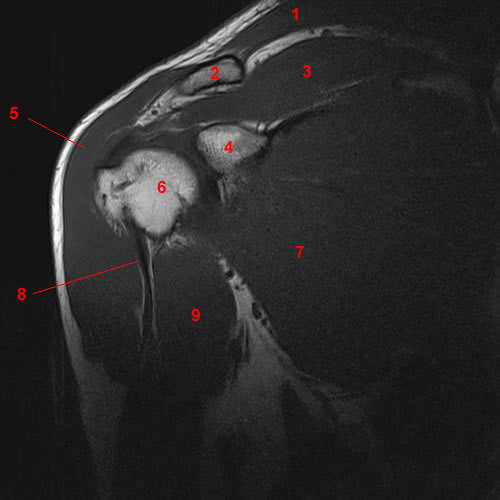 Clavicle Mri