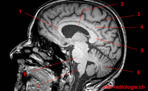 MRT-Atlas des menschlichen Gehirns