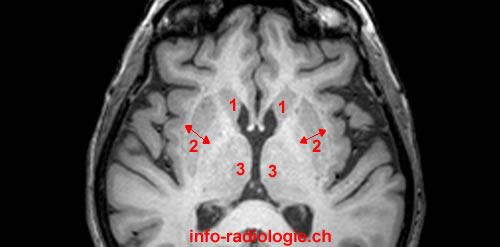 Index of /capsule-interne/fullsize