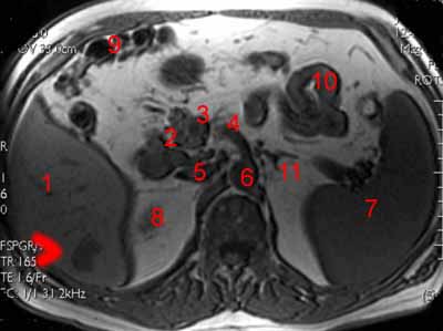 irm abdomen T1 - niveau 9