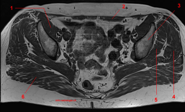 Anatomie IRM de la hanche