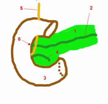 configuration pancreas divisum