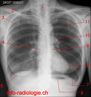 Radiographie du thorax: cliché de face.